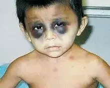 z_torture_iraq100.webp