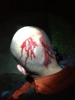 Zimmy wounds 22.webp