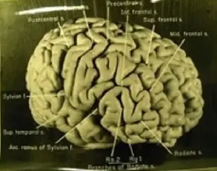 $Einsteins Brain Right photo.webp