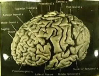 $Einsteins Brain Left photo.webp