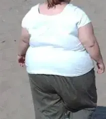 $obese woman2.webp