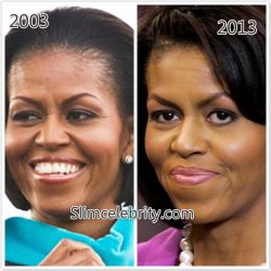 $Michelle-Obama-plastic-surgery-before-and-after-photos-nose-job-botox-injections-facelift.jpg