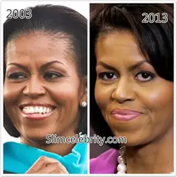 $Michelle-Obama-plastic-surgery-before-and-after-photos-nose-job-botox-injections-facelift.webp