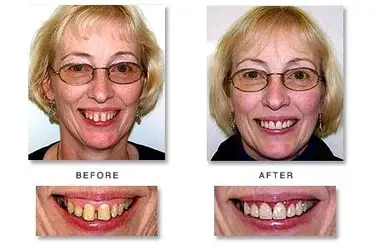 $happyface10.webp