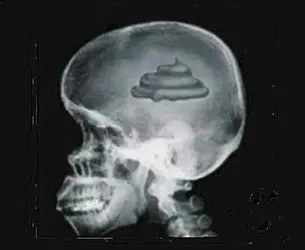 $Liberal_Shit-Brain-01.webp