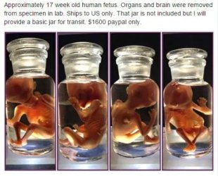 fetus 17 jars gop voters.jpg