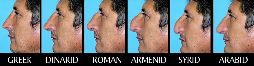 noses.jpg