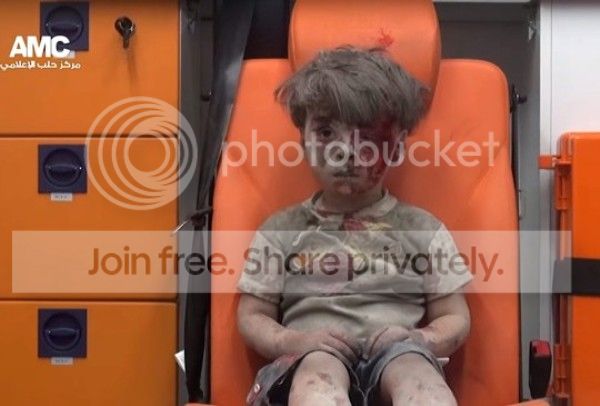 syrian-injured-boy_zpsmwhaykx5.jpg