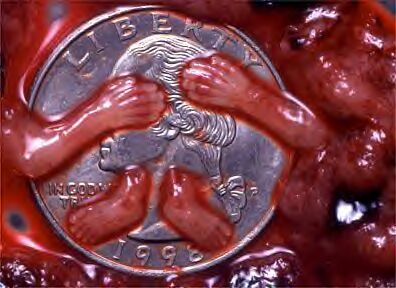 slaughtered_child-abortion.jpg
