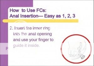 anal_condom_insertion-300x213_zpsggzac7fv.jpg