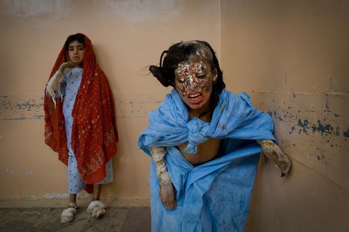two_children_bombing_victim_mirwais.jpg