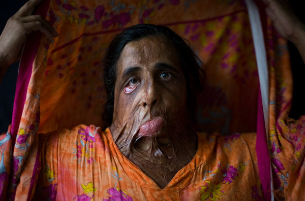 womanacidattack-vi.jpg
