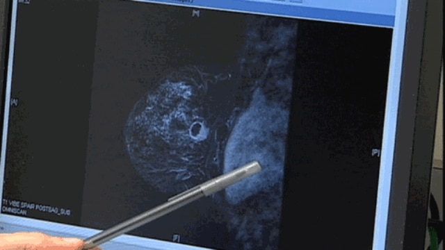 68378CDB-AB1D-45EC-8863-6EA1020C2035_w640_r1_s.gif
