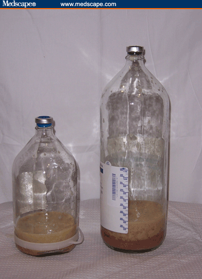 mgm547693.fig4.gif