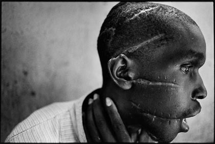 rwandan_machete_victim_1994.jpg