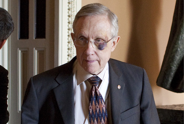 harry-reid-black-eye.jpg