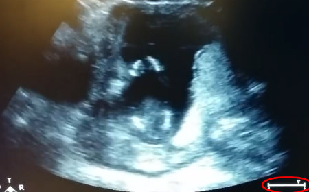 babyclaps.jpg