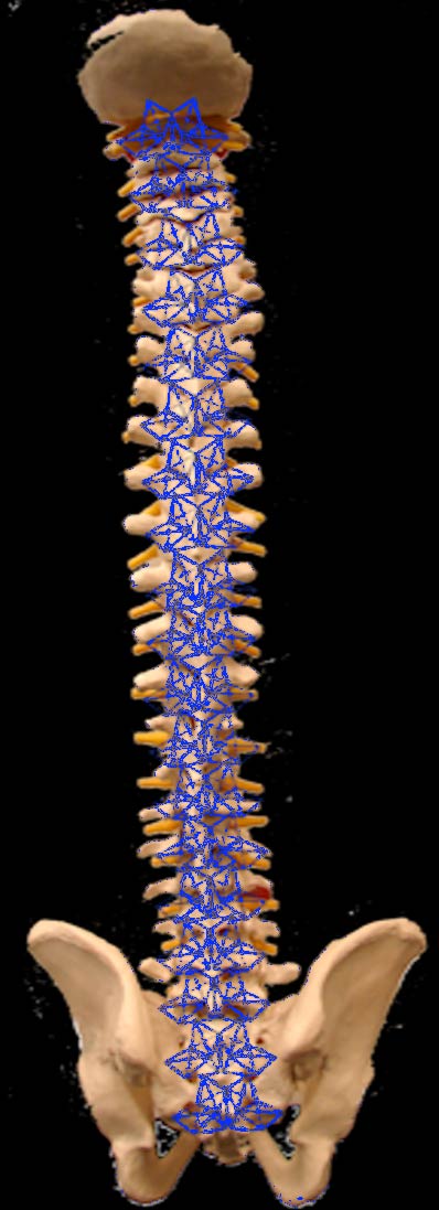 spineWithAmps.jpg