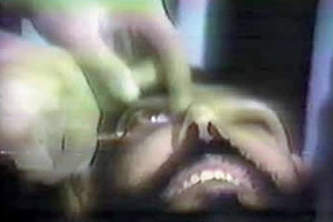 eye-gouging1-300.jpg