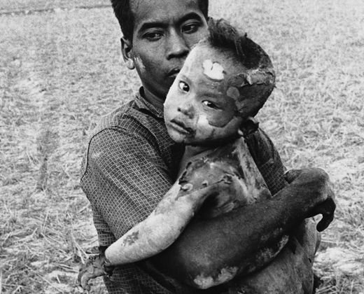 vietnam%20burned%20child.jpg