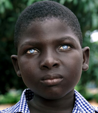 African-Boy-Blue-Eyes.png