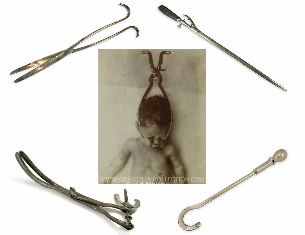 4-instruments-babyinforcep.jpg