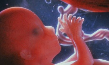 four-months-foetus-001.jpg