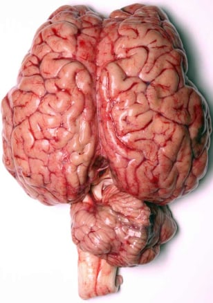 080418-human-brain-02-139p.grid-4x2.jpg