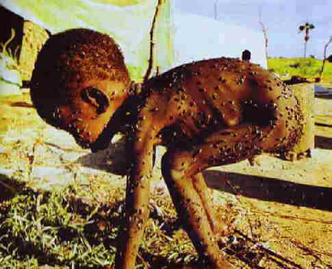 starving_baby.jpg