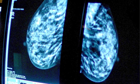 Mammogram-009.jpg