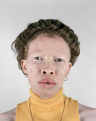 albino4.jpg