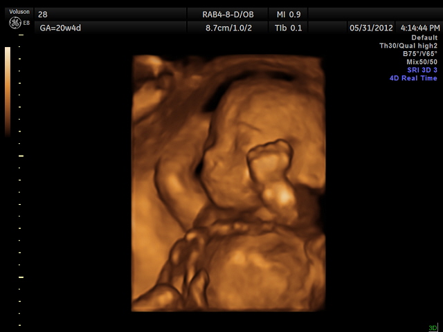 JORDI-BABY-20WEEKS_4.jpg