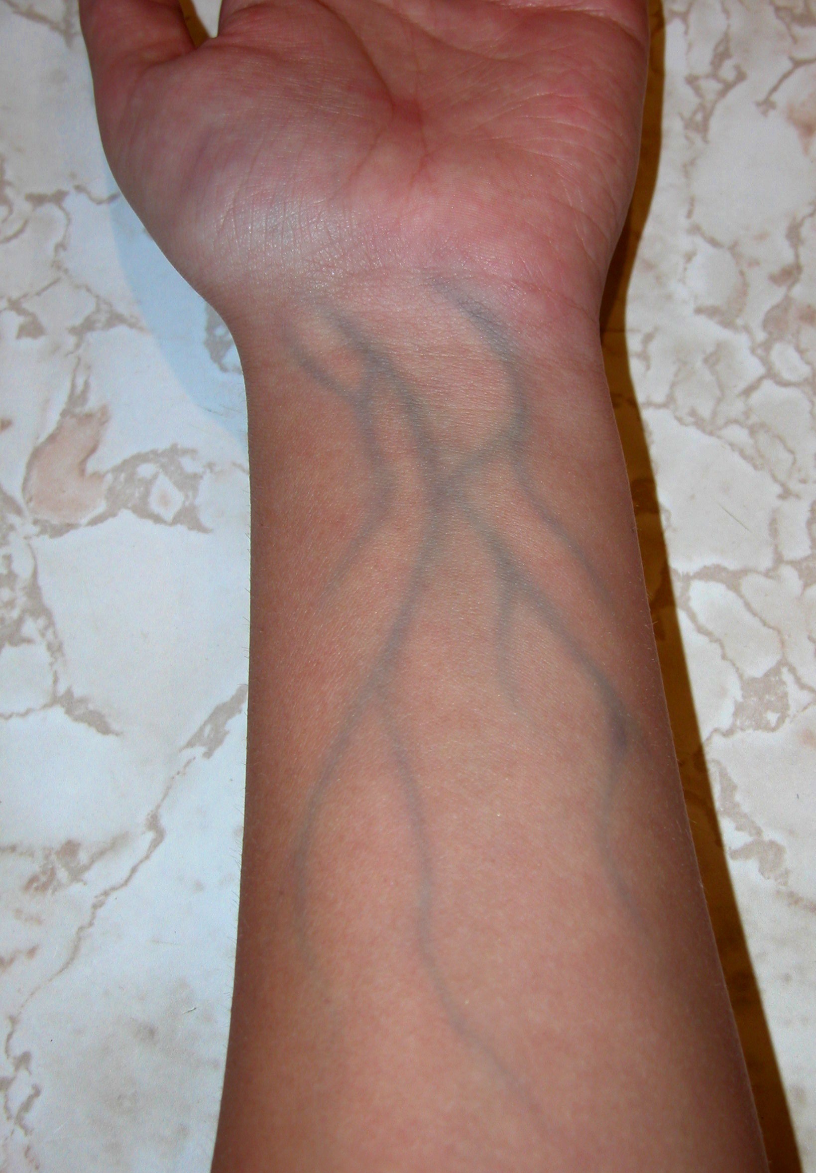 Veins-vampires-16444430-1639-2356.jpg