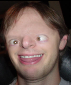 retard_27551753_140625054.jpg