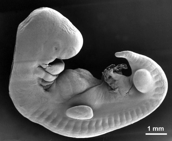 embryo.jpg