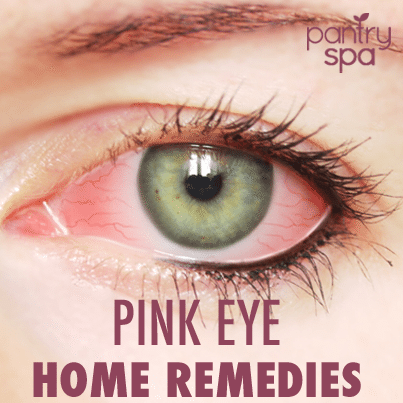 pink-eye-home-remedies-.png