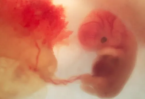 pregnancy_stages_s8_8_weeks.jpg