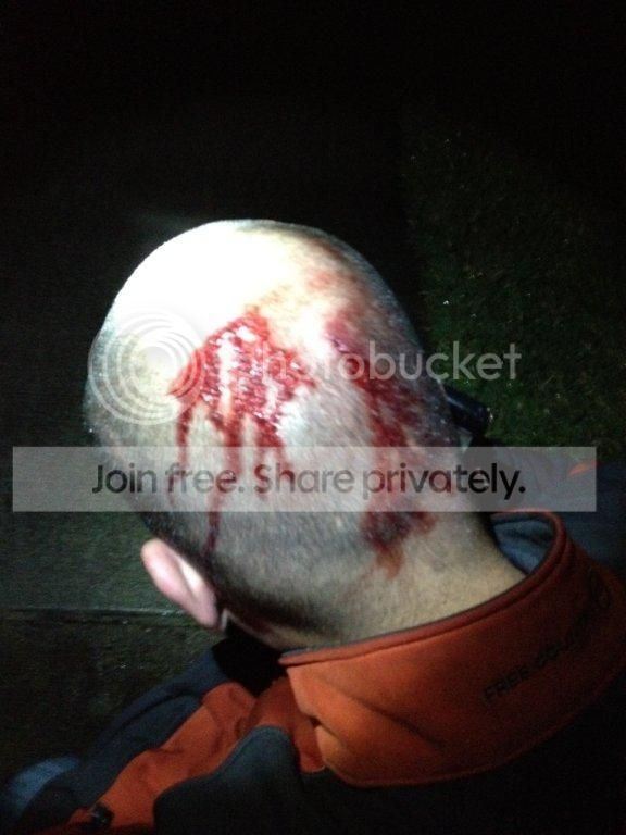 Zimmermanheadnotreallybleeding_zps6daa7885.jpg