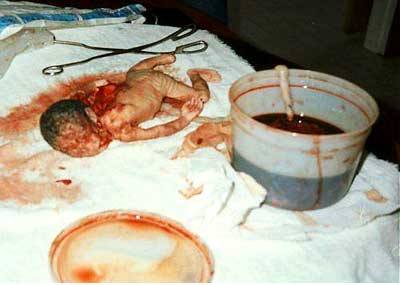 abortion05.jpg