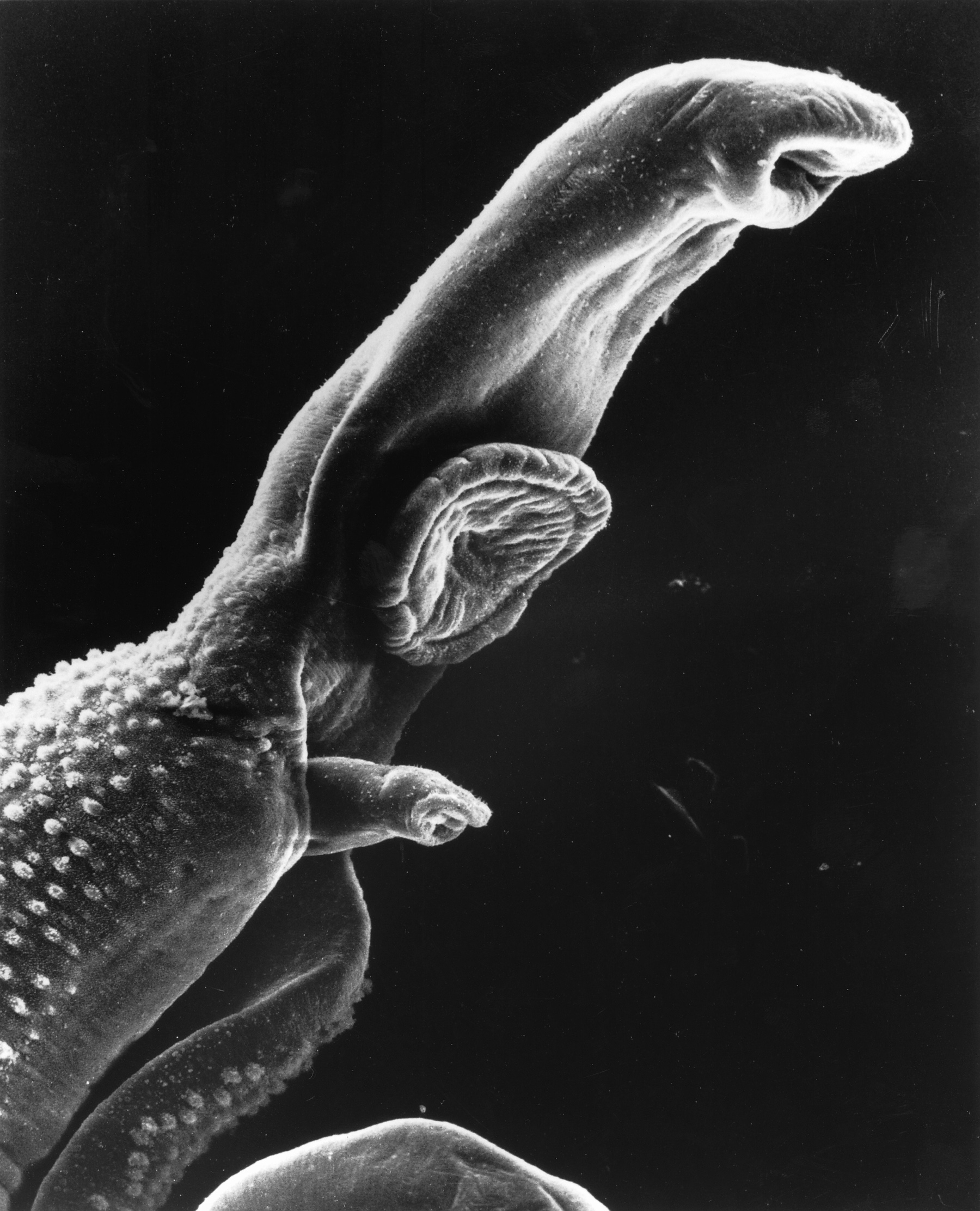 Schistosome_Parasite_SEM.jpg