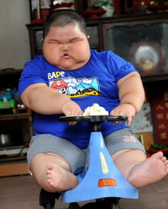 ObeseKid.jpg