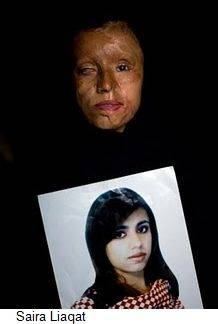 Saira-liaqat-acid-attack-victim.jpg