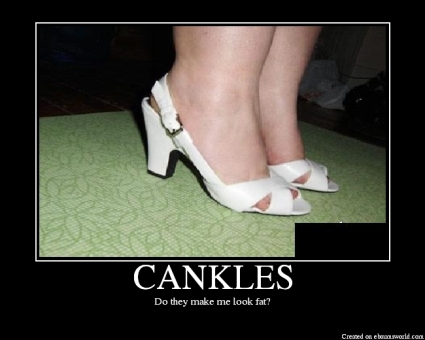 cankles1303958195.jpg