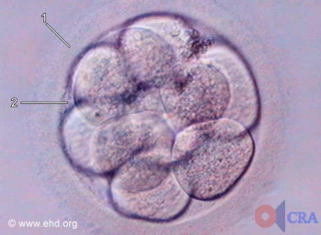 ten-cell-embryo.jpg