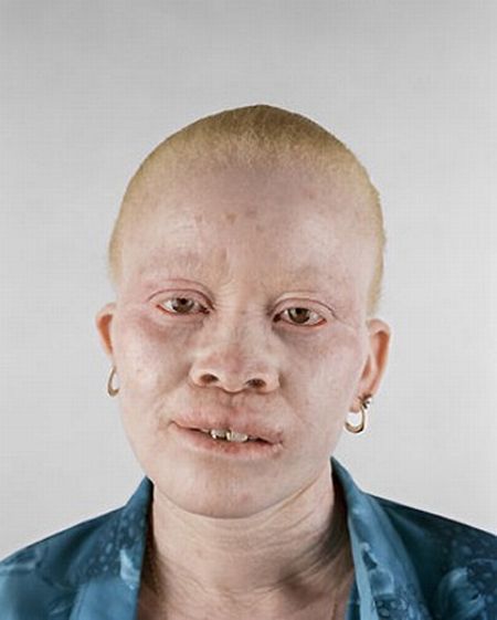 albino7.jpg