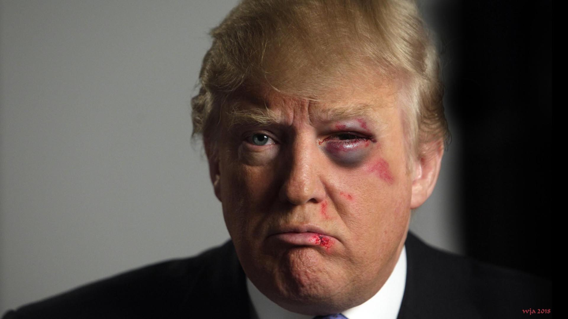Trump-blackeye.jpg