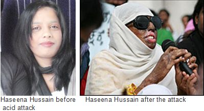 Haseena-Hussain-acid-attack.jpg