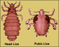 head-pubic-lice.gif